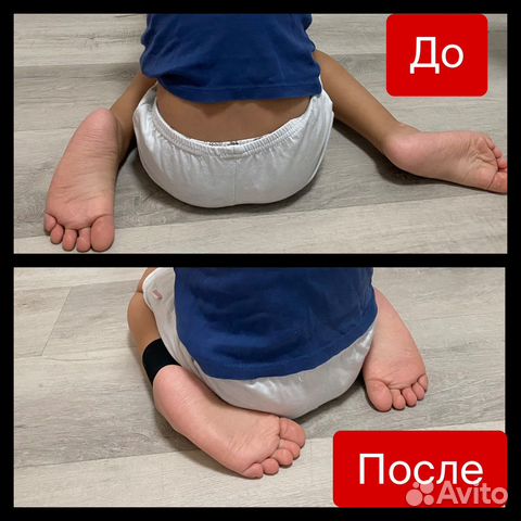 Манжета против позы W для детей с дцп